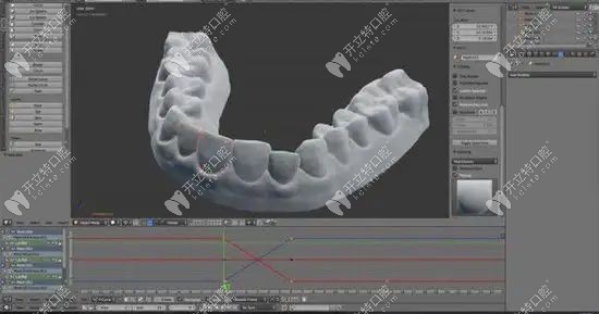 爱舒笑隐形矫正牙套是3d打印的吗?