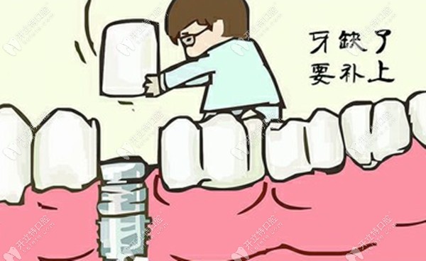7号牙齿缺失有必要做种植吗