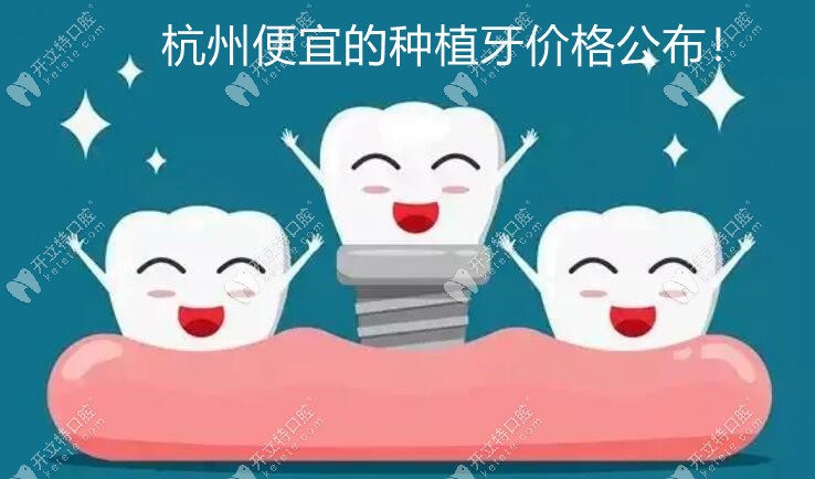 杭州种植牙价格便宜的要多少钱一颗?政策调整后单颗收费2980