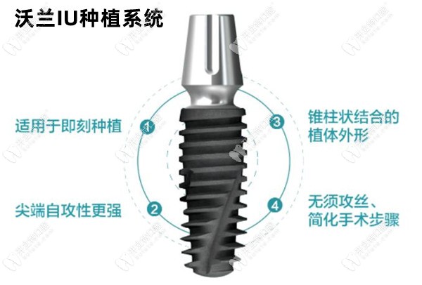 韩国沃兰IU种植系统优缺点