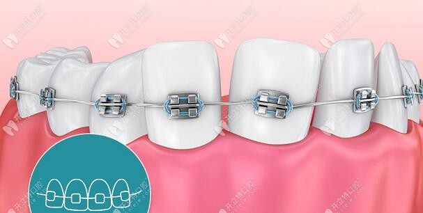 長沙好依生口腔牙齒矯正項目