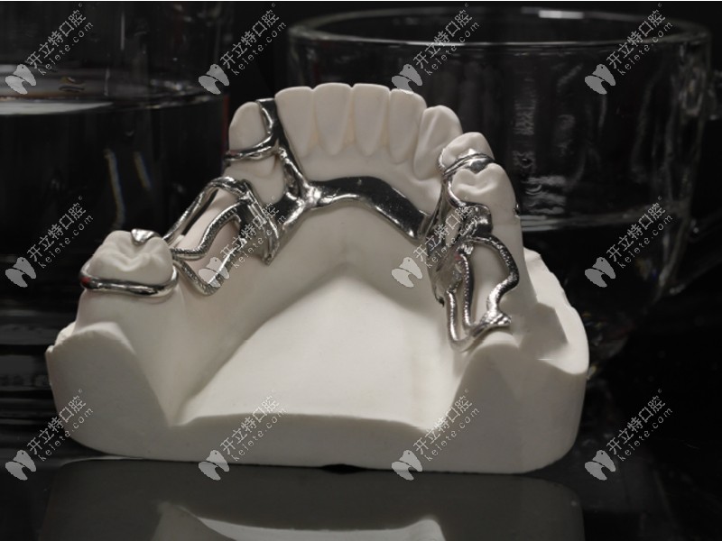 bpd是用于固定假牙的支架www.kelete.com