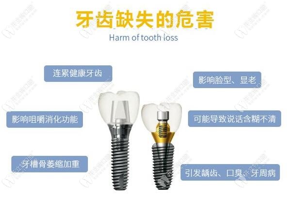 深圳光明新区种植牙价格表:微创单颗种植牙2980/全口种植牙4W