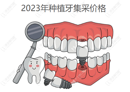 2023年种植牙集采价格www.waasee.com