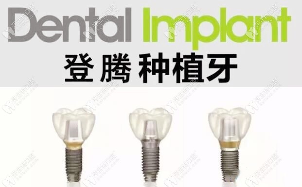 韓國登騰種植牙的優(yōu)勢kelete.com