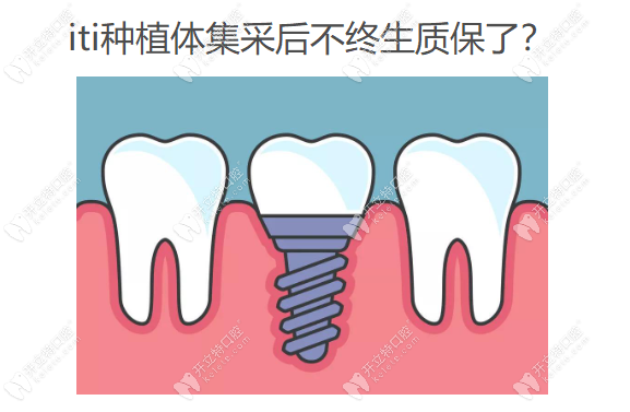 瑞士iti种植牙集采后不终生质保了？