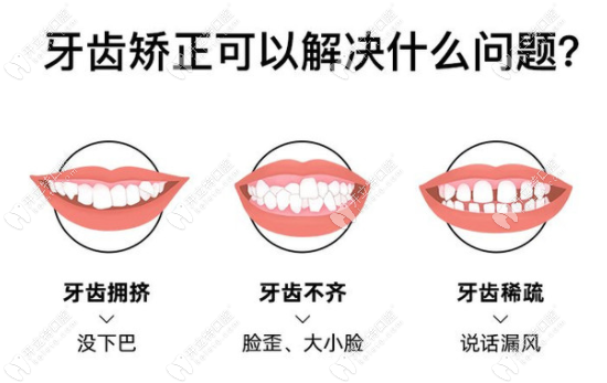 西安瑞泰口腔龙首店正畸怎么样