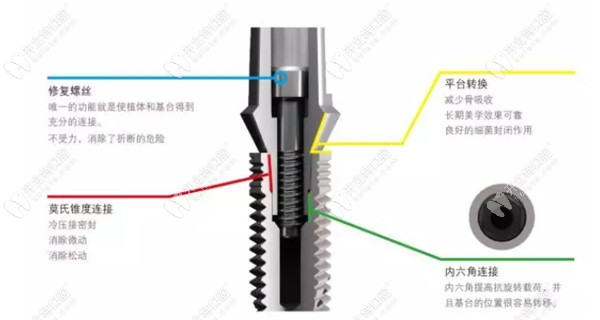 意大利bb种植牙集采价格