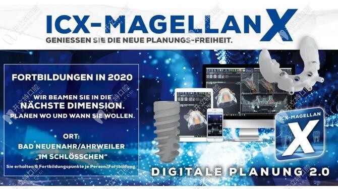 德国icx种植体系统示意图