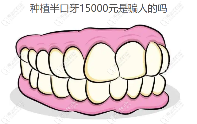 种植半口牙15000元是骗人的吗,半口半固定种牙价格15000+