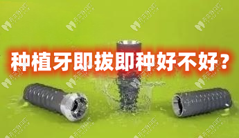 种植牙即拔即种好不好？看完即拔即种的利与弊就能知道