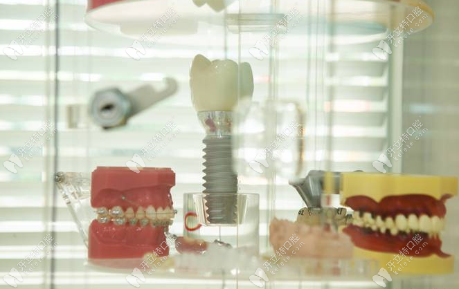 各种牙膜类型