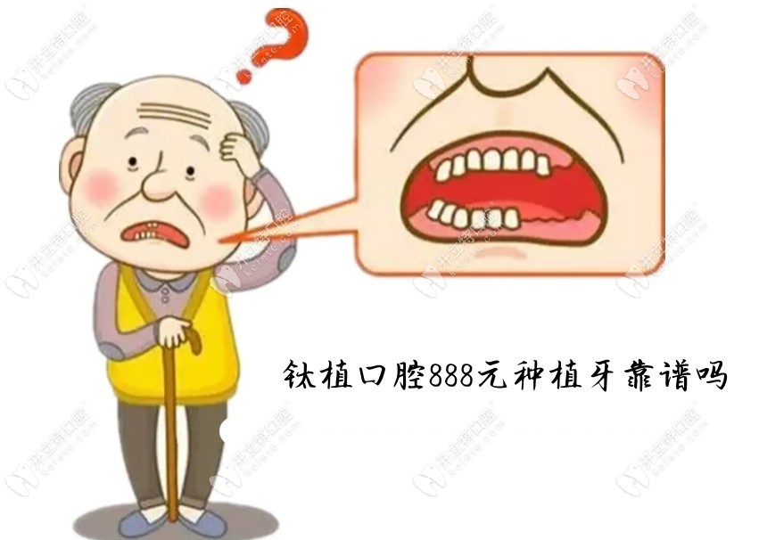 北京钛植口腔888元种牙是谣传并没有,种一颗牙价格至少1880起