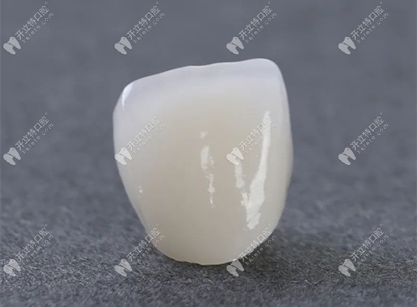 纯钛烤瓷牙和全瓷牙的区别在于价格,色泽,耐用及舒适度不同