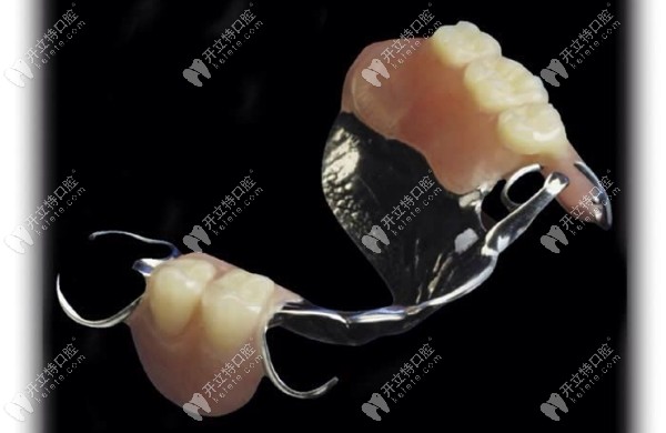 钛合金牙托和纯钛牙托哪个更好?纯钛牙托质量更好/但价格贵