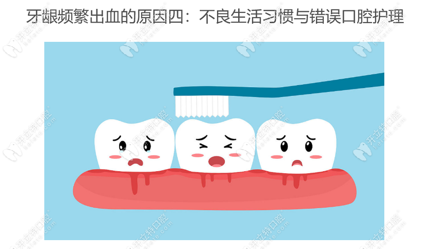 牙龈频繁出血是什么原因