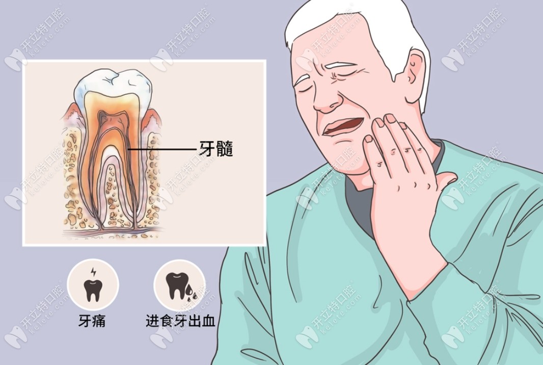 拔牙治疗牙髓炎的局限性