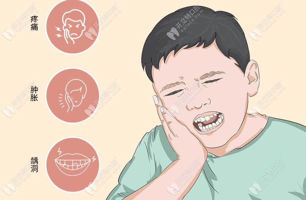 拔牙治疗牙髓炎的优势