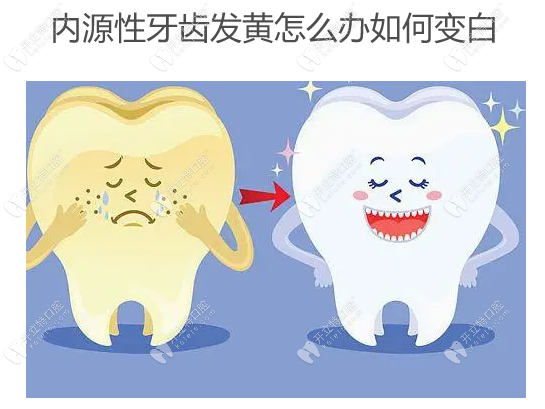 内源性牙齿发黄怎么办如何变白