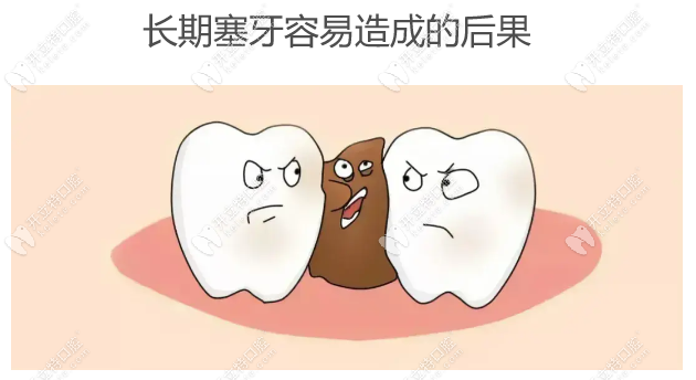 长期塞牙容易造成的后果