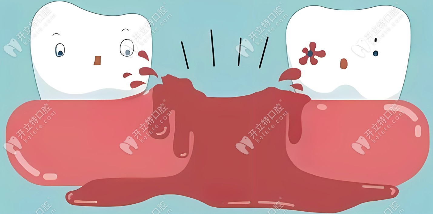 牙槽症一般会出现疼痛、口臭、伤口异常