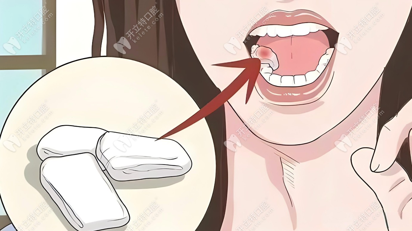 牙槽症状一张口受限
