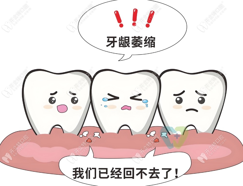 牙龈萎缩牙根外露保守治疗的方法