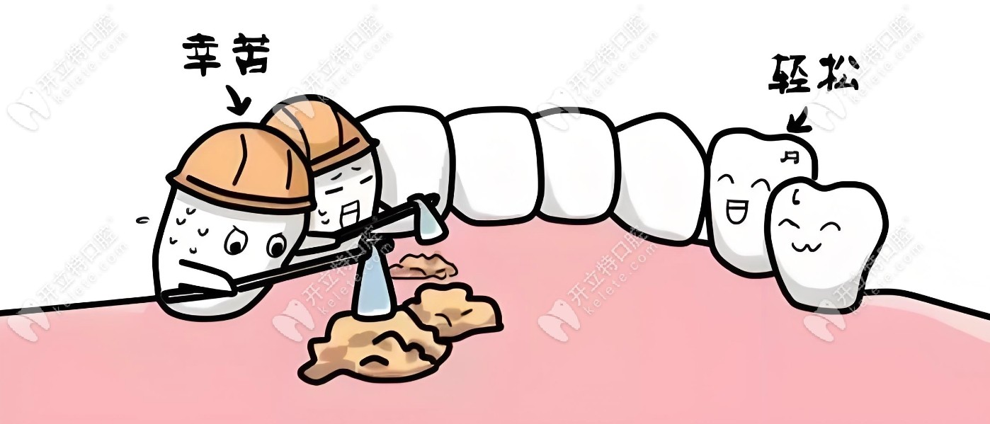 牙龈萎缩牙根外露保守治疗方法——药物治疗