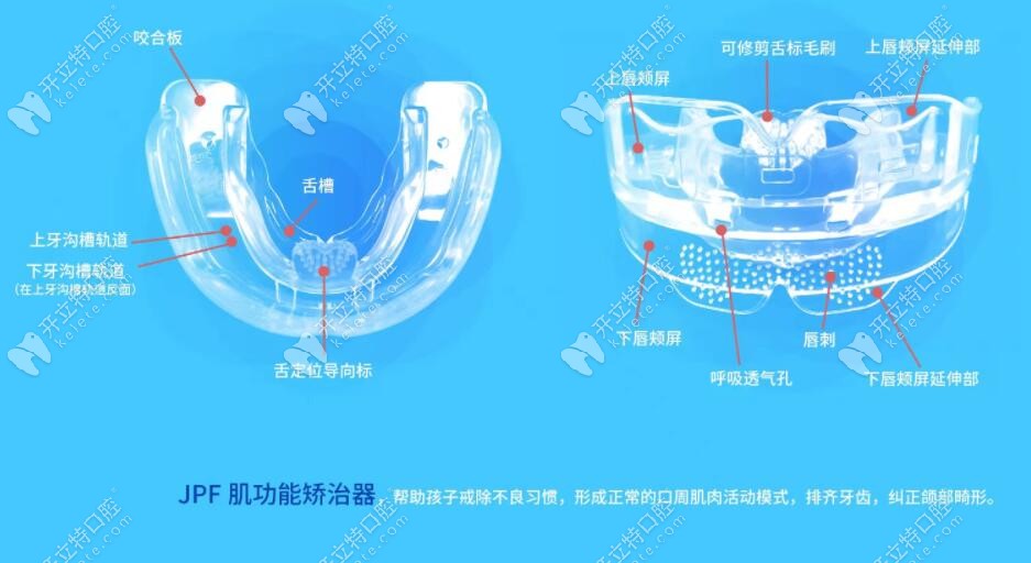 JPF儿童矫治器适应3-15岁儿童的口腔早期干预