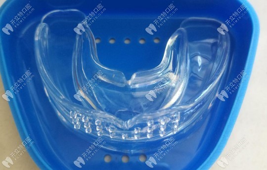 儿童牙齿矫正器的种类及价格www.kelete.com