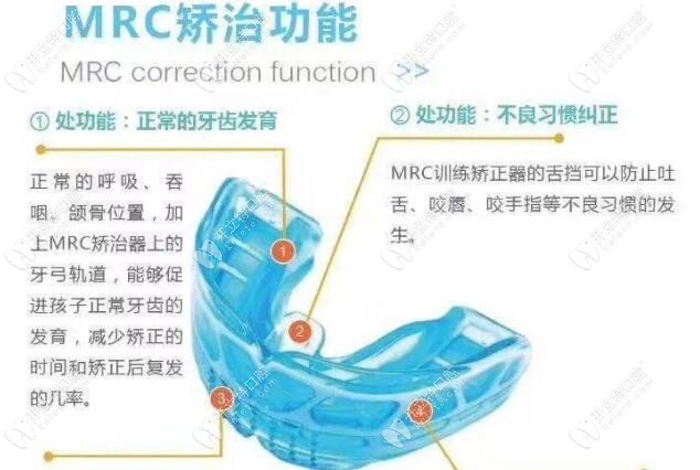 MRC肌功能矫治器需要一年左右