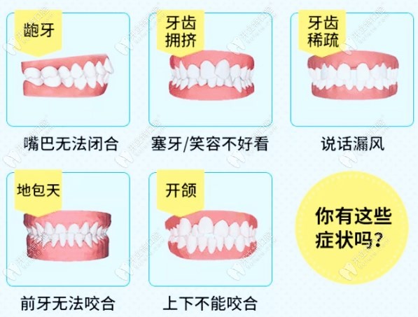 深圳龙岗牙齿矫正多少钱