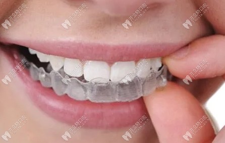 长沙芙蓉区牙齿矫正多少钱？