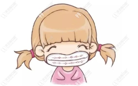 合肥美奥矫正牙齿价格