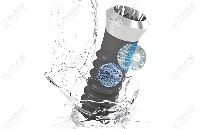 種植親水種植牙