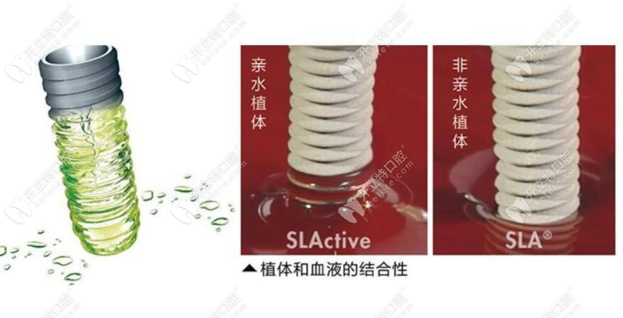 種牙親水和非親水區(qū)別