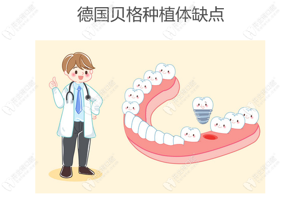 德国贝格种植体缺点