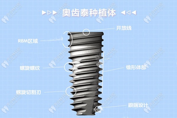 瑞士iti和奥齿泰种植牙怎么选