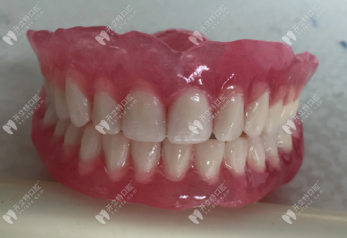 隐形义齿和活动义齿的区别是什么?咀嚼力/材质/适应症不同