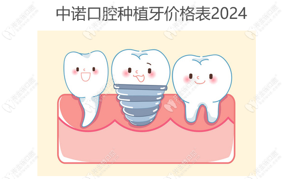 中诺口腔种植牙价格