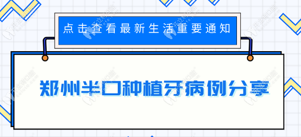 郑州半口种植牙病例分享