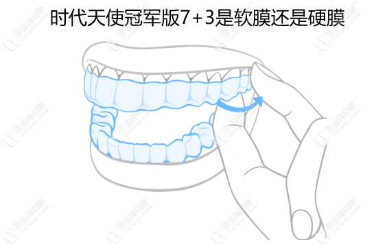 时代天使冠军版7+3是软膜还是硬膜