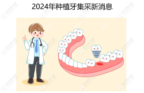 2024年种植牙集采新消息