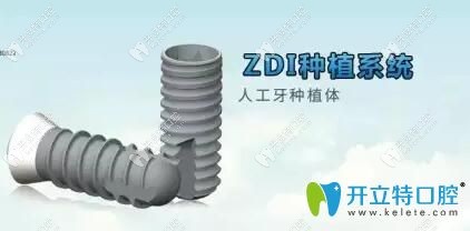 ZDI人工牙種植體