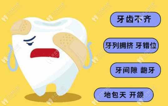 福州登特口腔醫(yī)院矯正牙齒