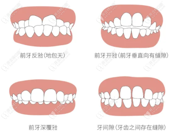 漳州美潔口腔牙齒矯正價格表