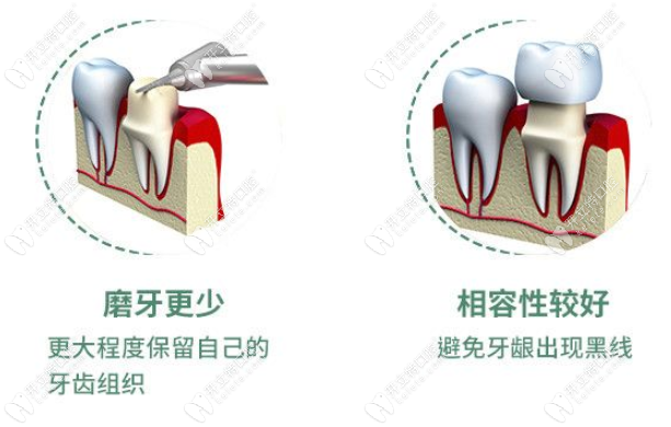 連江維樂口腔全瓷牙項目價格