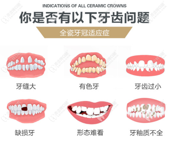 美特爾口腔洗牙價(jià)格表