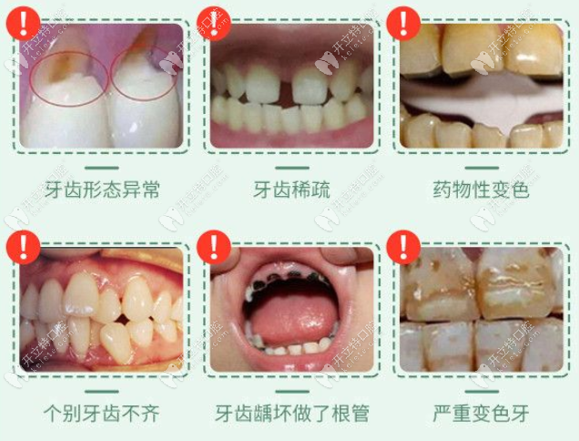 牙齒做嵌體和牙冠的壽命對(duì)比