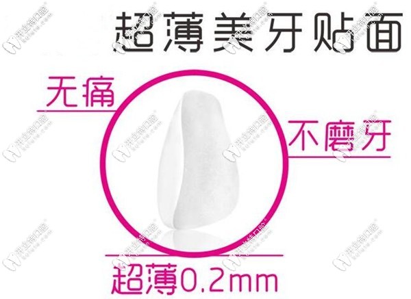 天津中诺口腔做瓷贴面靠谱吗